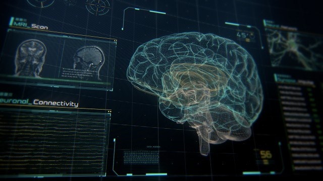 MRI Scan Interface with Human Brain, Neurons and Data.